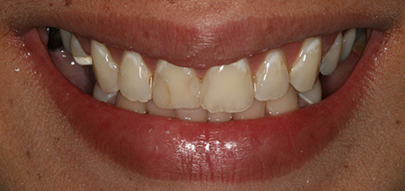 Case seven before smile enhancement